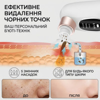 Вакуумний очищувач пор обличчя з водним потоком Super Micro Bubble — апарат для гідропілінгу та аквапілінгу від чорних точок, 5 режимів, 5 насадок, USB