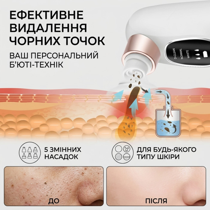 Вакуумний очищувач пор обличчя з водним потоком Super Micro Bubble — апарат для гідропілінгу та аквапілінгу від чорних точок, 5 режимів, 5 насадок, USB